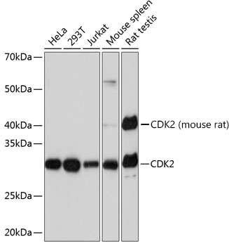 [KO Validated] CDK2 Rabbit mAb