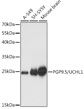 PGP9.5/UCHL1 Rabbit pAb