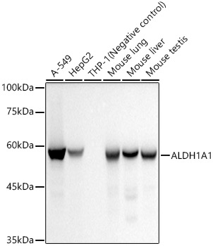 ALDH1A1 Rabbit mAb