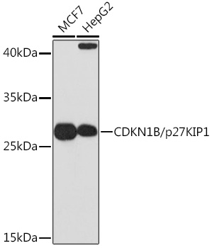 CDKN1B/p27KIP1 Rabbit pAb