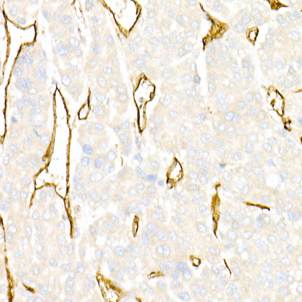 専用　cd31枚 CD31 (PECAM-1) Monoclonal Antibody (WM-59 (WM59)) (14-0319-82)