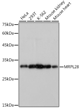 MRPL28 Rabbit mAb