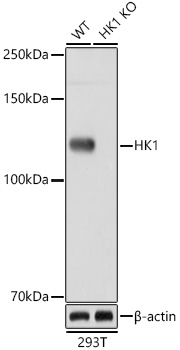 [KO Validated] HK1 Rabbit mAb