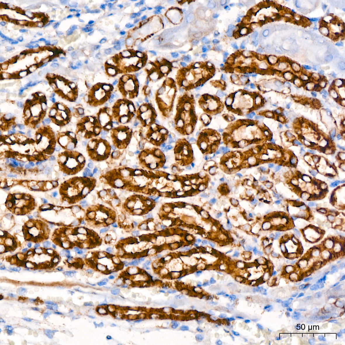 KO Validated] HK1 Rabbit mAb