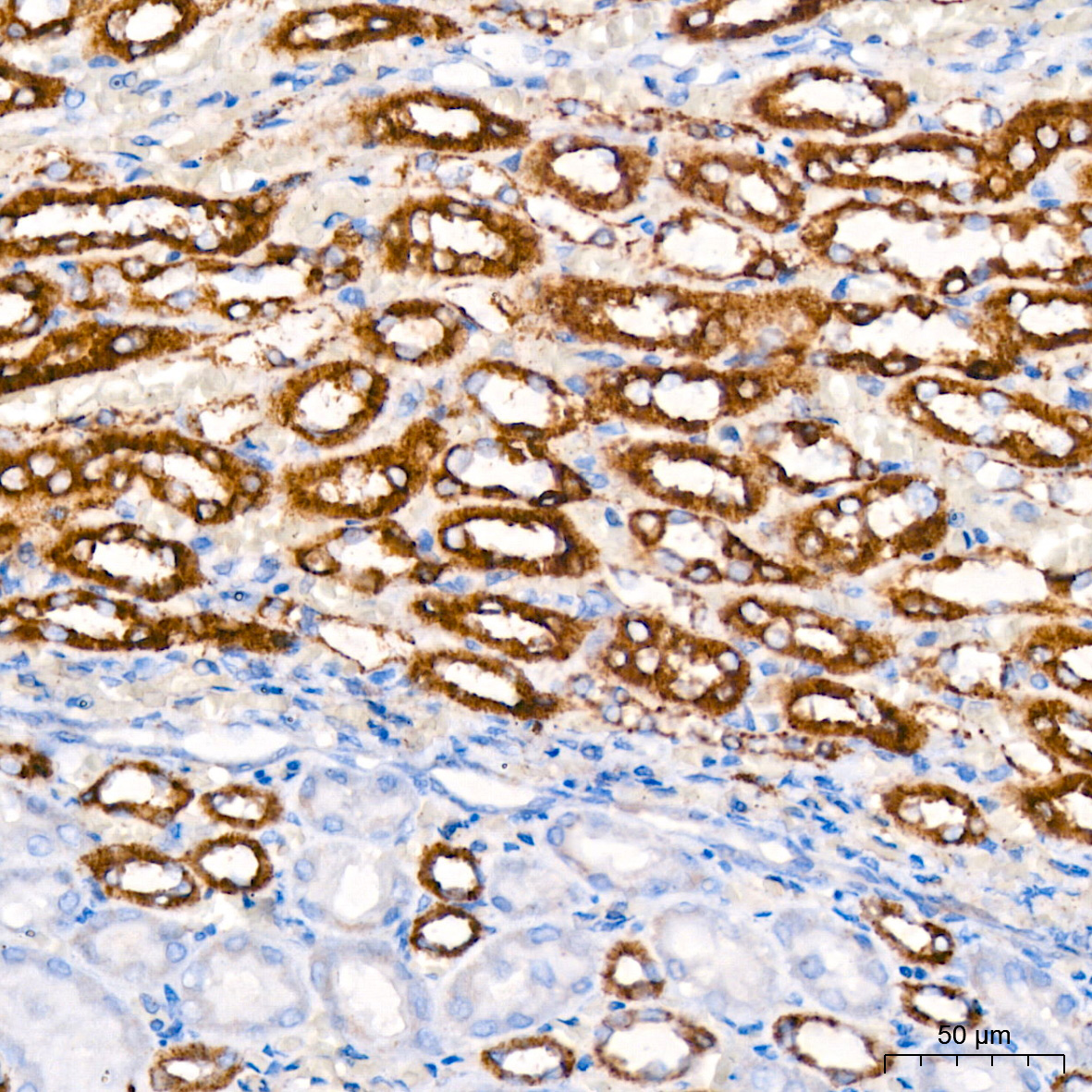 KO Validated] HK1 Rabbit mAb