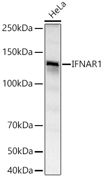 IFNAR1 Rabbit mAb