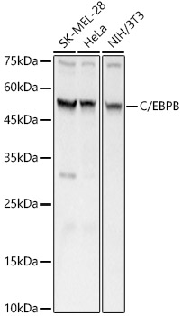 C/EBPB Rabbit pAb