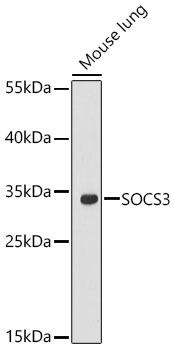 SOCS3 Rabbit pAb