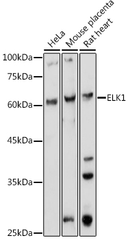 ELK1 Rabbit pAb