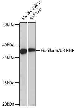 Fibrillarin/U3 RNP Rabbit mAb