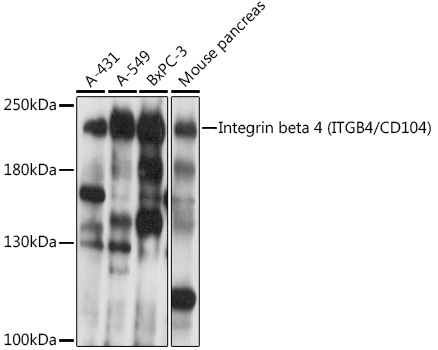 Integrin beta 4 (ITGB4/CD104) Rabbit pAb