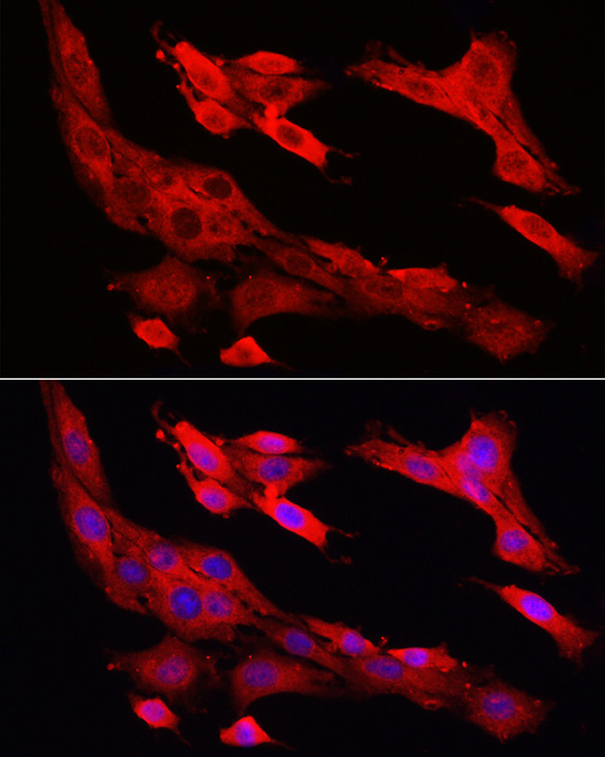 おまとめ【cal167】【aph74】 Phospho-Estrogen Receptor α (Ser167) (D5W3Z) Rabbit mAb
