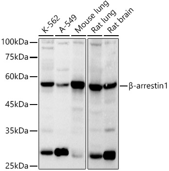 β-arrestin1 Rabbit pAb