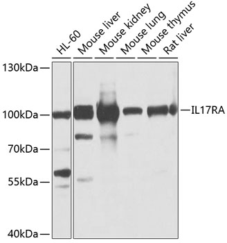 PE Rabbit anti-Human IL-17RA/CD217 mAb