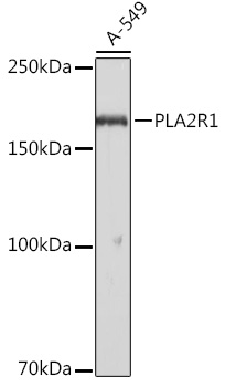 PLA2R1 Rabbit pAb