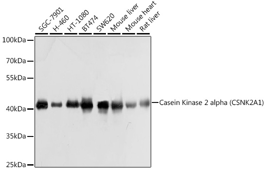 Casein Kinase 2 alpha (CSNK2A1) Rabbit pAb