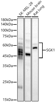 SGK1 Rabbit pAb