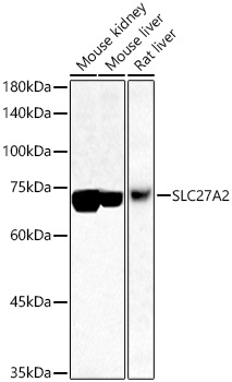 SLC27A2 Rabbit pAb