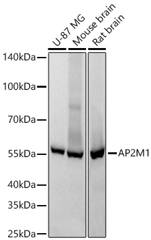 AP2M1 Rabbit mAb