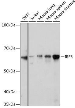 IRF5 Rabbit mAb