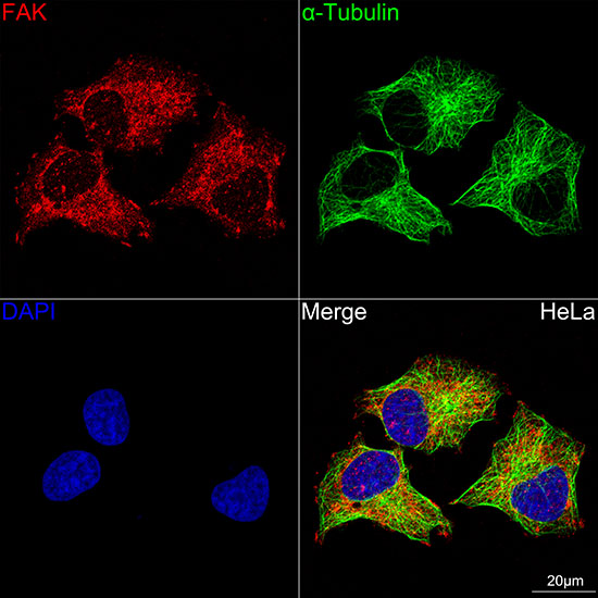 FAK Rabbit mAb