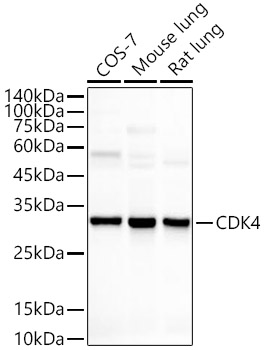 [KO Validated] CDK4 Rabbit mAb