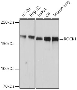 ROCK1 Rabbit mAb