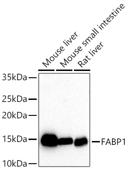 FABP1 Rabbit mAb