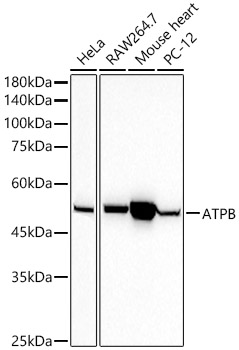 ATPB Rabbit mAb