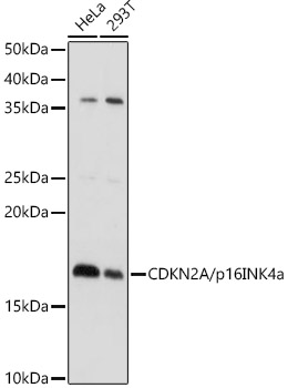 CDKN2A/p16INK4a Rabbit pAb