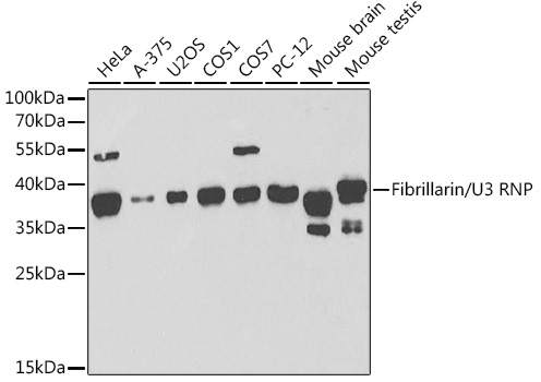 Fibrillarin/U3 RNP Rabbit pAb