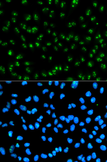 Fibrillarin/U3 RNP Rabbit pAb