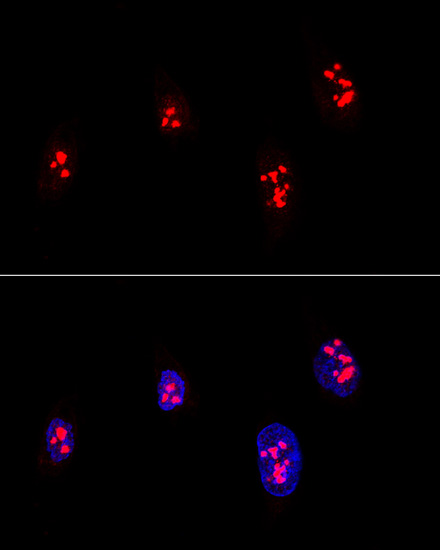 Fibrillarin/U3 RNP Rabbit pAb