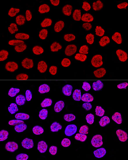 Histone H2AX Rabbit pAb