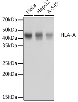 HLA-A Rabbit mAb