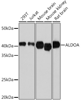 ALDOA Rabbit mAb