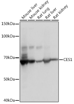 CES1 Rabbit mAb