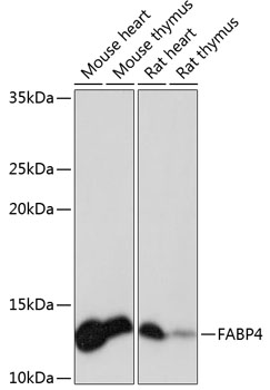 FABP4 Rabbit mAb