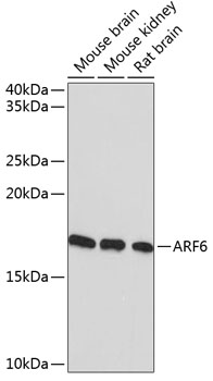 ARF6 Rabbit mAb