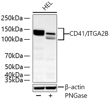 CD41/ITGA2B Rabbit mAb