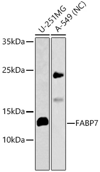 FABP7 Rabbit pAb