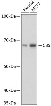 CBS Rabbit mAb