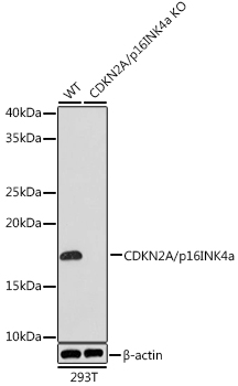 [KO Validated] CDKN2A/p16INK4a Rabbit mAb