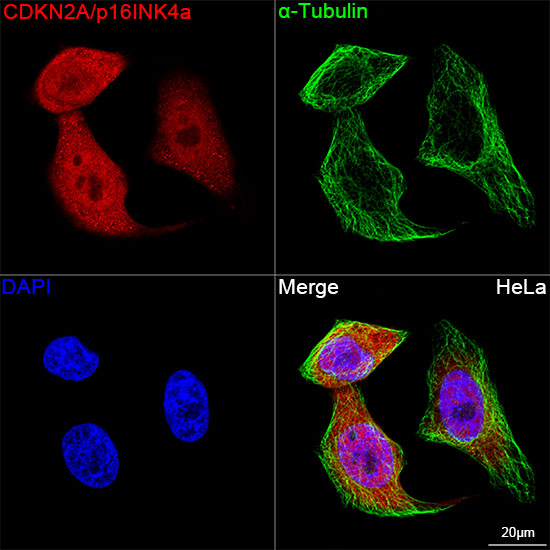KO Validated] CDKN2A/p16INK4a Rabbit mAb