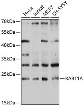 RAB11A Rabbit pAb