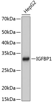 IGFBP1 Rabbit mAb