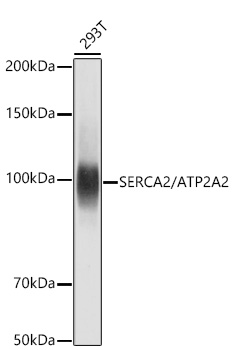 SERCA2/ATP2A2 Rabbit mAb