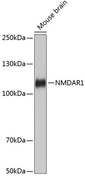 NMDAR1 Rabbit mAb