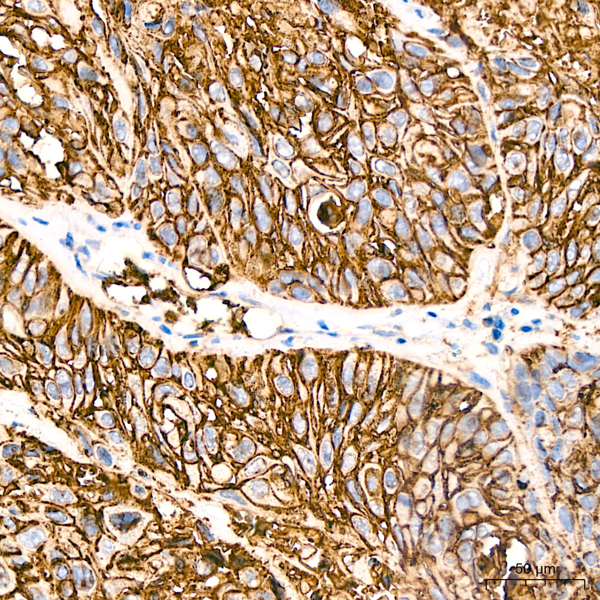 GLUT1/SLC2A1 Rabbit mAb