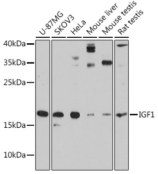 recombinant human lr3 igf-1 LR3-IGF-1(E51R) Protein Набор из 4-х средств Format:50 capsules L-glutamine